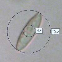 Spores of Leccinum versipelle
