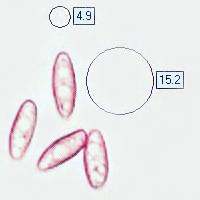 Spores of Neoboletus luridiformis
