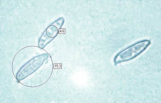 Spores of Pseudoboletus parasiticus