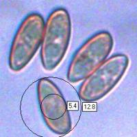 Spores of <em>Suillellus luridus</em>