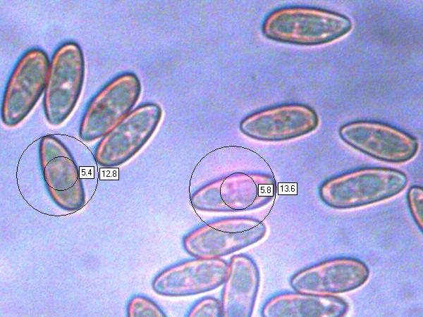 Spores of Suillellus luridus