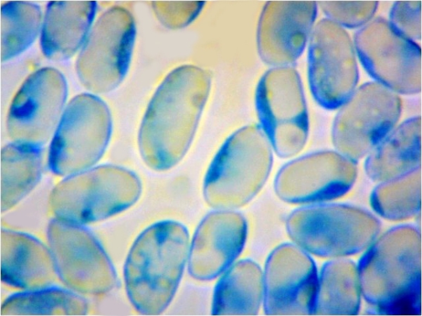 Spores of Cantharellus amethysteus
