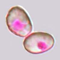 Spores of Craterellus cornucopioides
