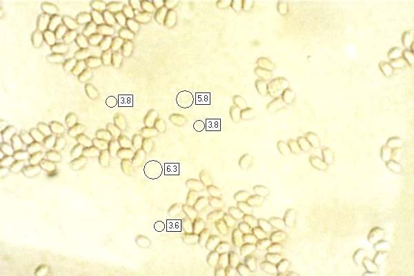 Spores of Clavaria fragilis