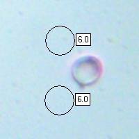 Spore of Clavulinopsis fusiformis