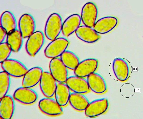 Spores of Cortinarius alboviolaceus