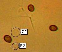 Spores of Cortinarius bolaris
