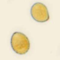 Spores of Cortinarius delibutus