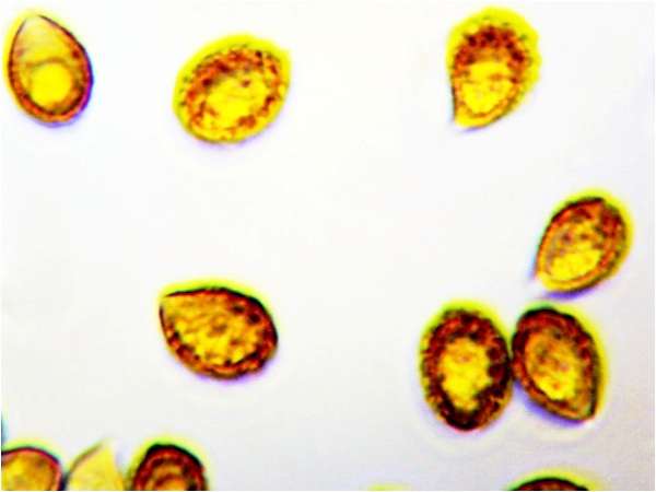 Spores of Cortinarius hinnuleus