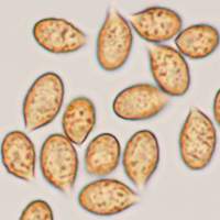 Spores of <em>Cortinarius saturninus</em>