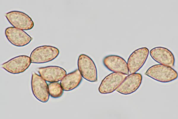 Sporess of Cortinarius triumphans