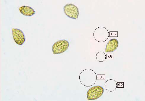 Sporess of Cortinarius trivialis