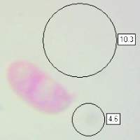 Spores of Calocera viscosa