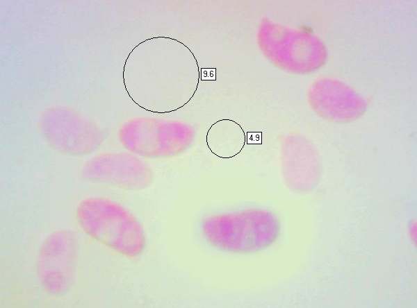 Spores of Calocera viscosa