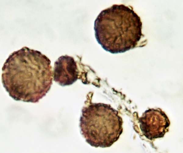 Spores of Astraeus hygrometricus