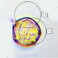 Spore of Entoloma atromadidum