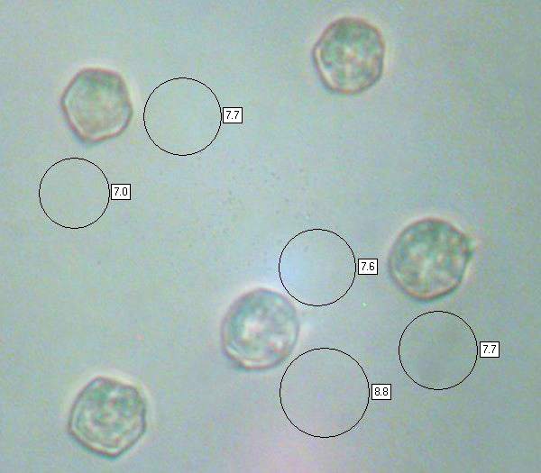 Spores of Entoloma bloxamii