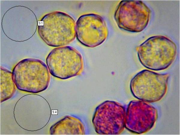 Spores of Entoloma clypeatum