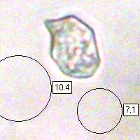 Spores of Entoloma lampropus