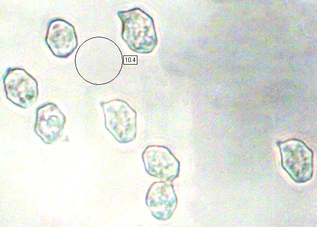 Spores of Entoloma lampropus