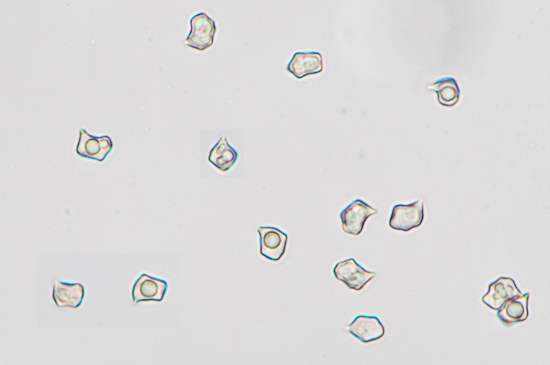 Spores of Entoloma lucidum