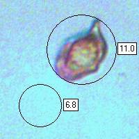 Spores, Entoloma mougeotii