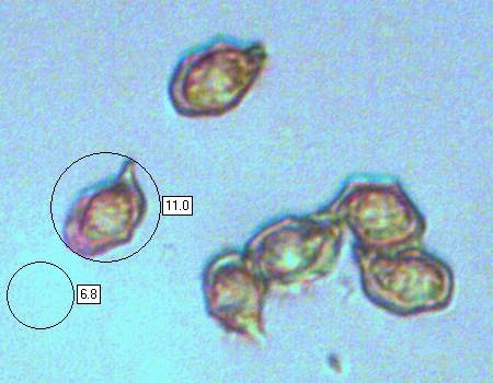 Spores of Entoloma mougeotii