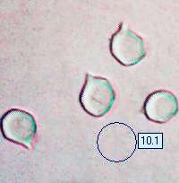 Spores of Entoloma sinuatum