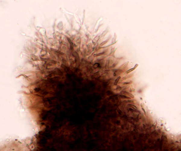 Papillae of Exidia glandulosa