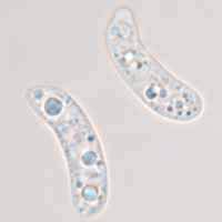 Spores of <em>Exidia glandulosa</em>