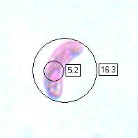 Spore, Exidia nigricans