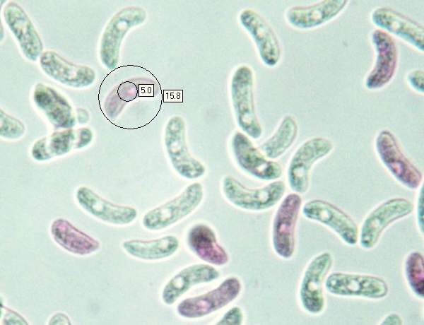 Spores of Exidia nigricans