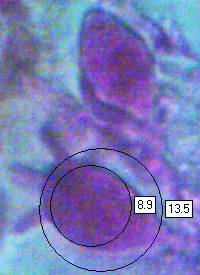 Immature basidia of Exidia recisa, showing elongated sterigmata