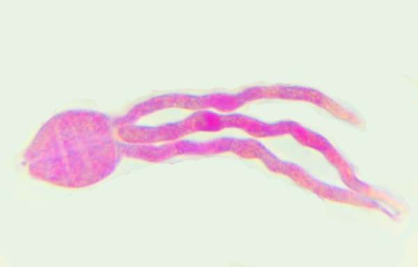 Basidia of Guepinia helveloides