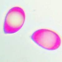 Spores of Guepinia helveloides, Salmon Salad fungus