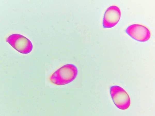 Spores of Guepinia helveloides