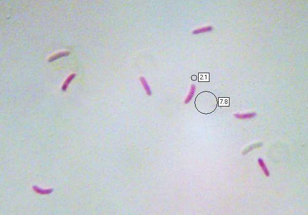 Spores of Daedaleopsis confragosa