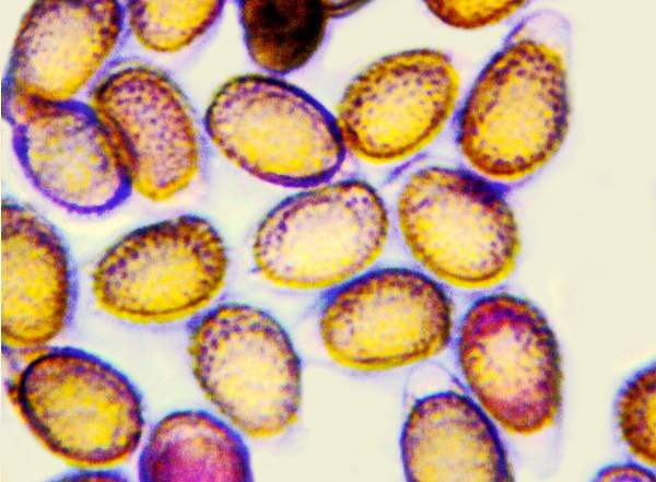 Spores of Ganoderma pfeifferi