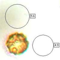 Spores, Geastrum coronatum