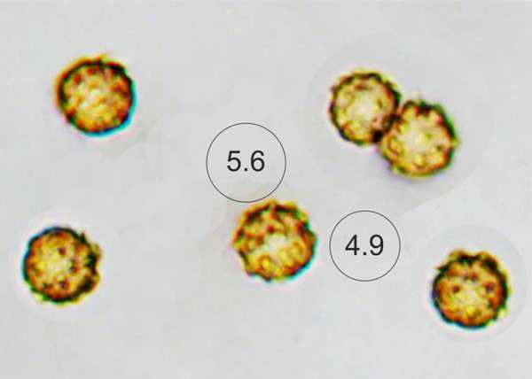 Spores of Geastrum coronatum