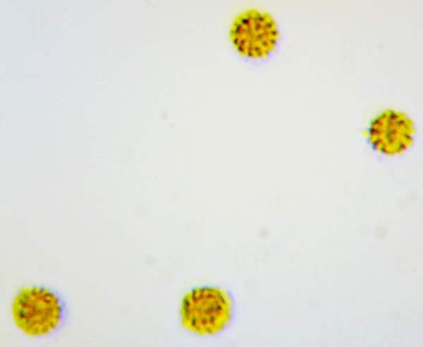 Spores of Geastrum fimbriatum