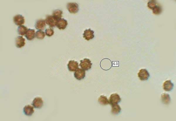 Spores of Geastrum striatum