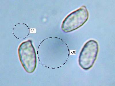Spores of Ramaria abieina