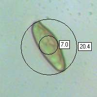 Spores of Chroogomphus rutilus, Copper Spike mushroom