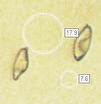 Spores of Gomphidius roseus