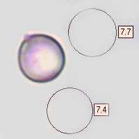 Spores of Hydnum repandum