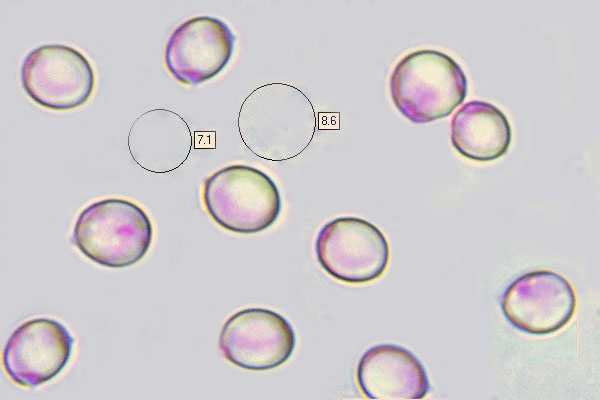 Spores of Hydnum repandum