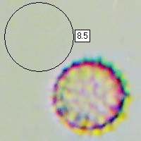 Spores of Laccaria amethystina