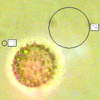 Spores of Laccaria fraterna, GumtreeDeceiver