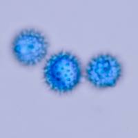 Spores of <em>Laccaria laccata</em>